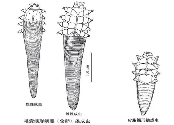 螨蟲